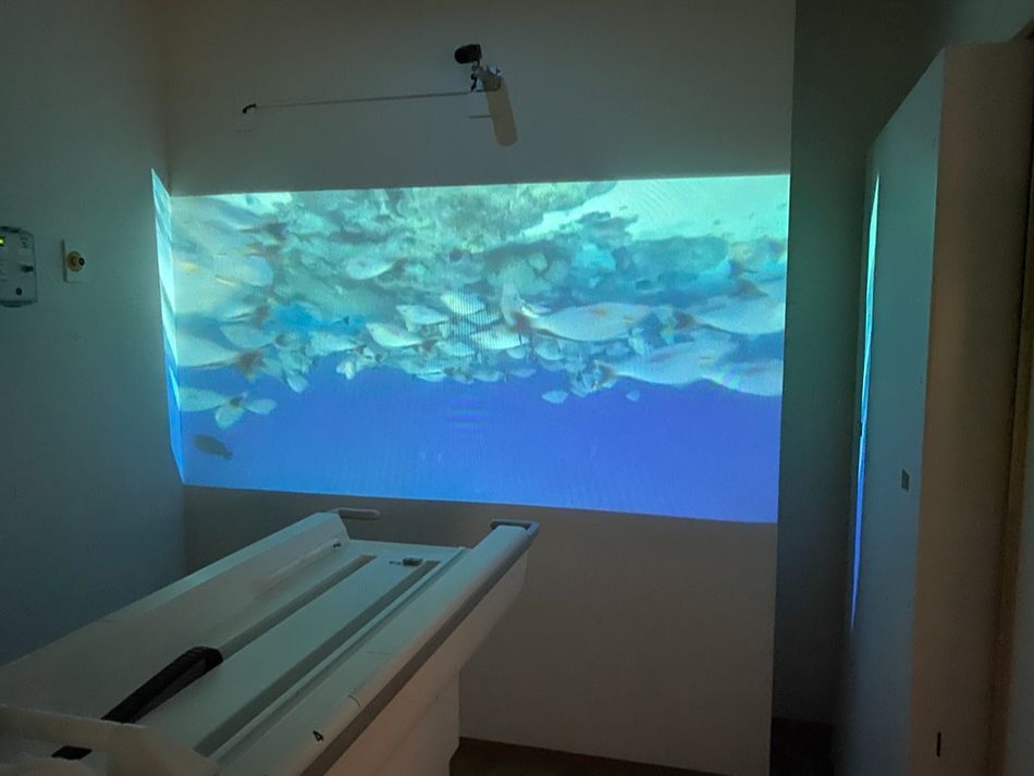 MRI 映像スクリーン